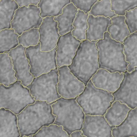 SYNENTEC Cornea Cell Count