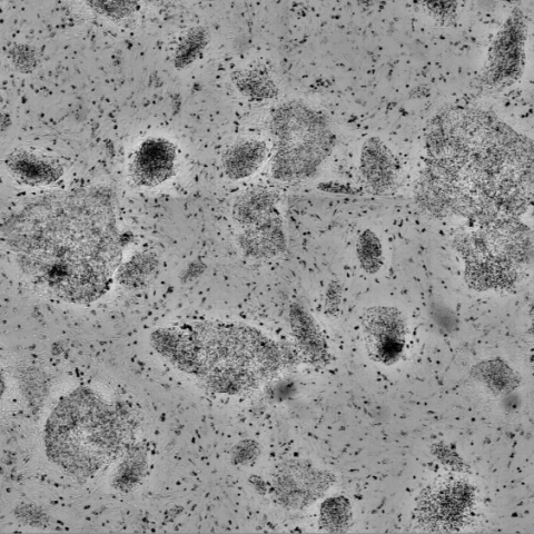 SYNENTEC iPS Cells on Feederlayer