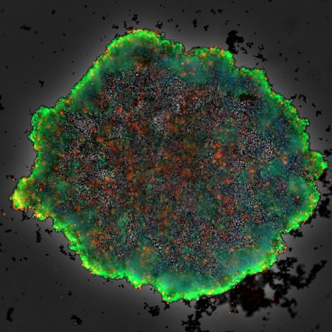 synentec_spheroid_livedead_ula-plate_brightfield.jpg