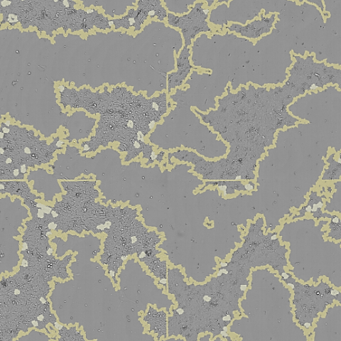 SYNENTEC_Viral plaque assay
