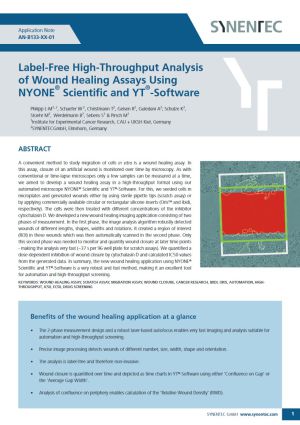 Wound Healing Assay, Proliferation, Cell Migration,Ibidi, Oris, High throughput, Automation, Gap Closure, Cancer Research, Scratch Wound Assay, Drug screening, EC50, IC50